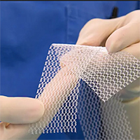 mesh1