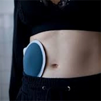 ostomy