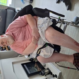 28-inch-razat-600-michael-case-study